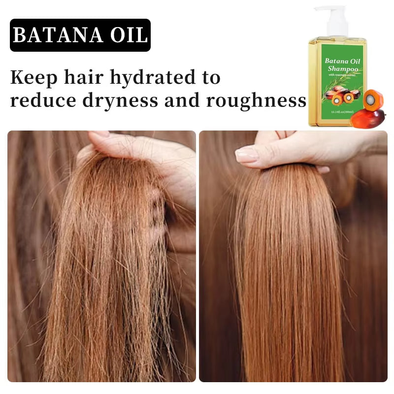 Private Label Batana Extract Hair Growth Shampoo Reduces Dandruff Strengthen Roots Batana Oil Shampoo